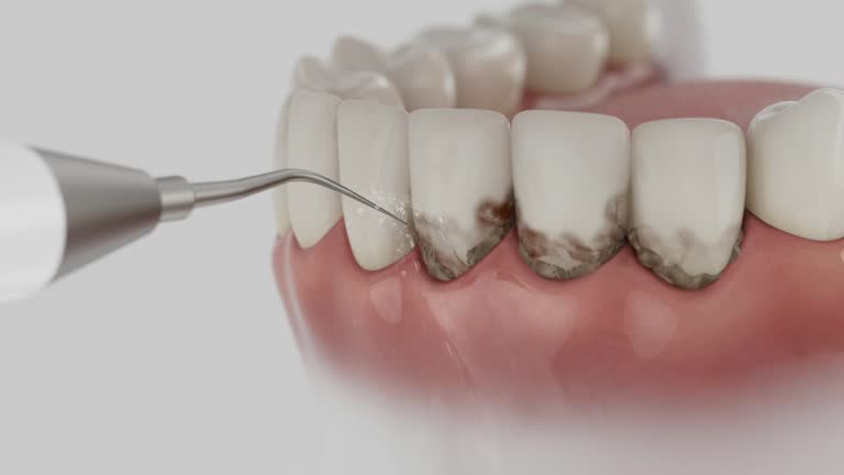 Trusted Root Canal Treatment service in Middlebranch, OH - Dentist Open Now